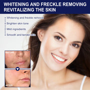 Brightening Skin And Reducing Melanin Cream