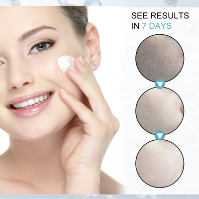 Facial Moisturizing Blackspot Removing Cream