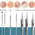 8pcs Ultra-fine Beauty Salon Acne Needle Tool Set Mi tienda