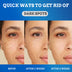 Fade Spot Cream Brightening White Moisturizing Cream