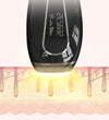 Home Laser Hair Removal Device for Full Body Care