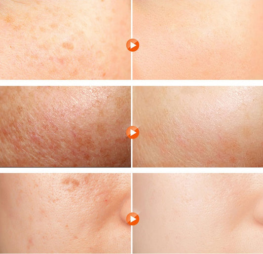 R·RASHEL Whitening Night Cream