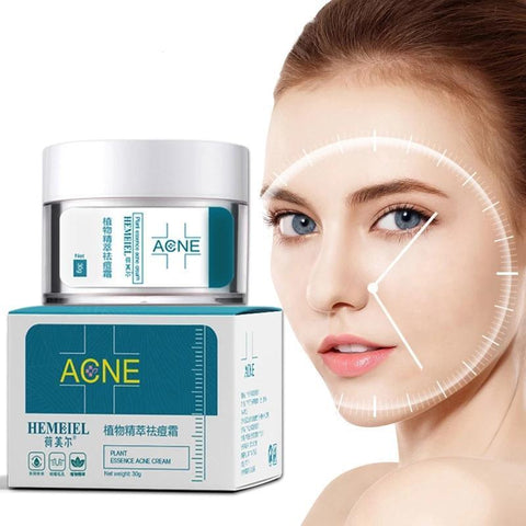 Acne Cream for Clear Skin | Pimples Removal & Scar Repair Formula