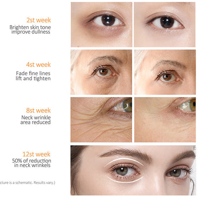 Moisturizing Fade Fine Lines Dark Circles Brightening Eye Bag Cream