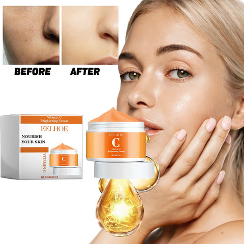 Acne Nourishing And Brightening Cream Douson Odeh