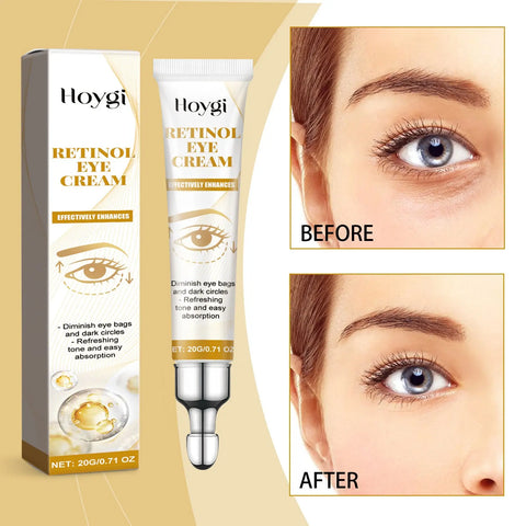 Retinol Eye Cream Moisturizing Fading Wrinkle Douson Odeh